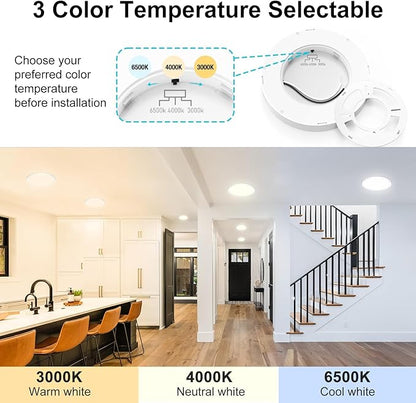 libtit 6 Pack 7 Inch Led Ceiling Light Flush Mount, 15W 1500Lm Ceiling Light Fixtures, 3000K/4000K/6500K Color Options, Round Surface Mount Led Light Fixtures for Hallway Laundry Garage